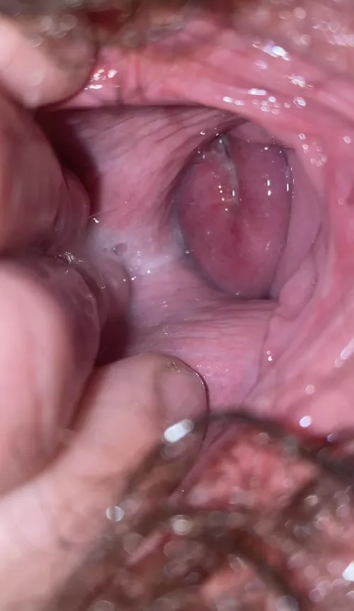 Got a real good picture of my cervix would you lick all the cum up? by Mygirl666_