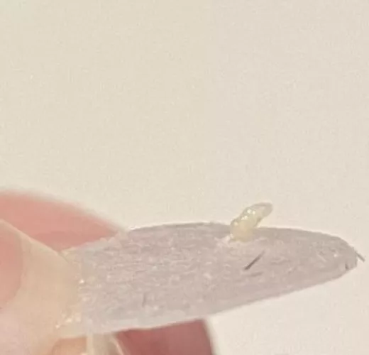 I pulled my pimple patch off and this happened... by kimikimikei