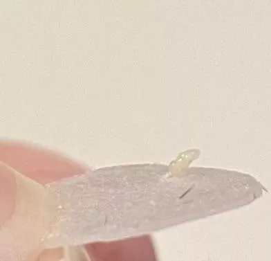 I pulled my pimple patch off and this happened... posted by kimikimikei