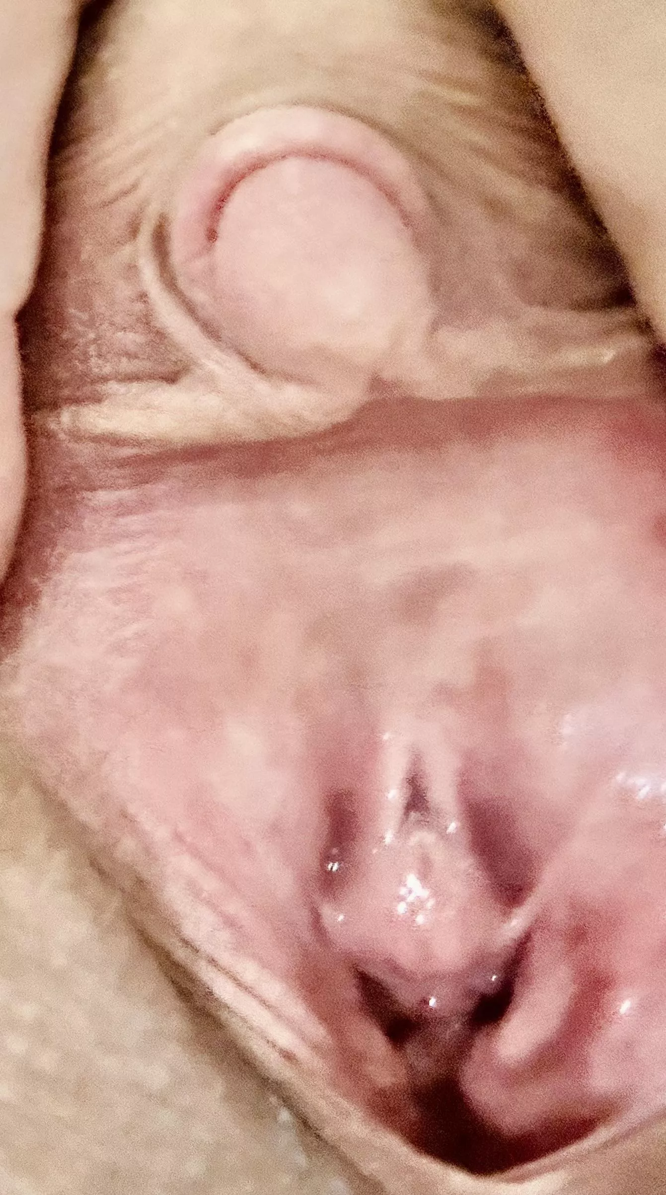 Puffy clit small hood posted by FancyBox13