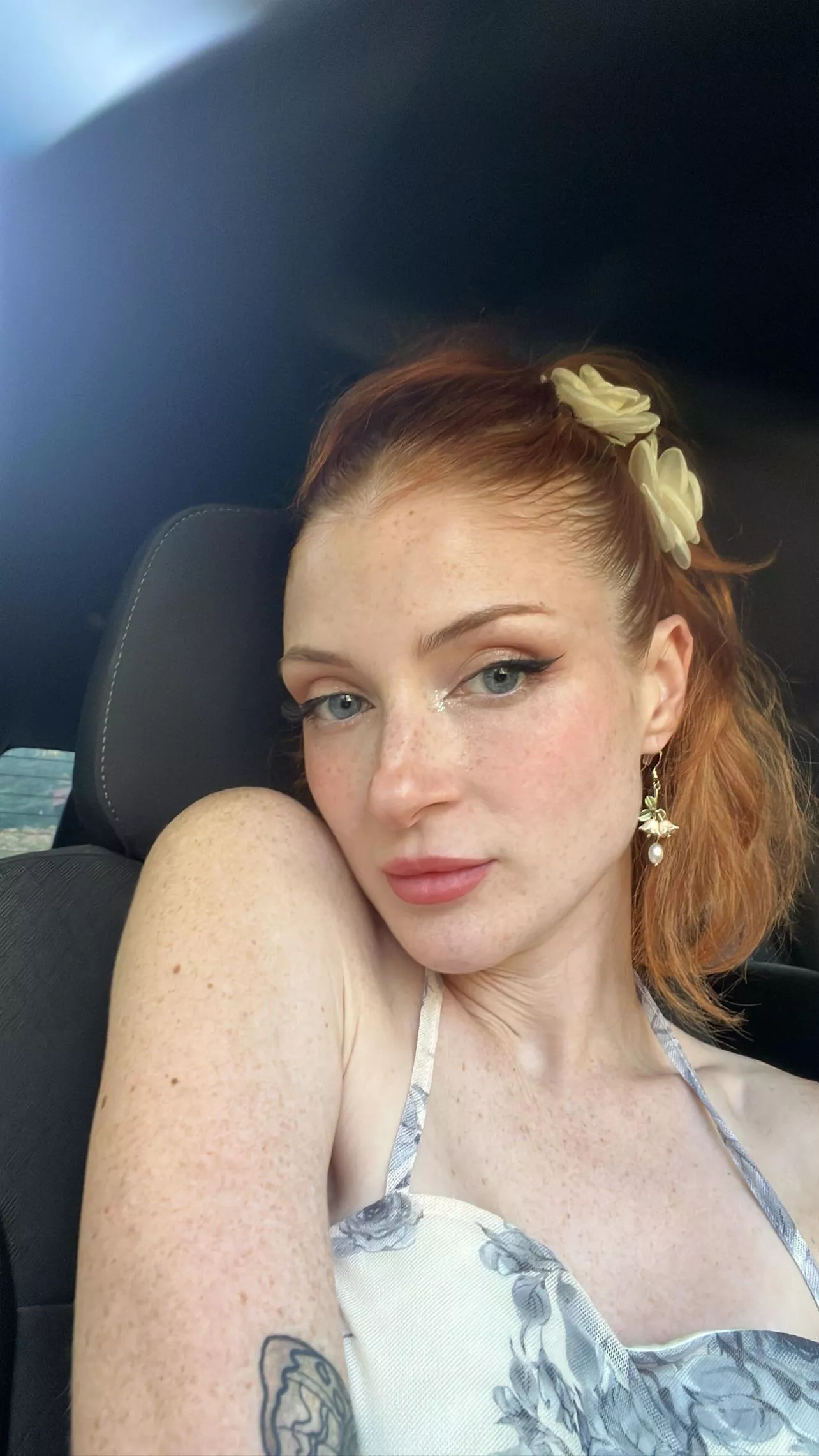 Freckle power! posted by Katierosecolorglz