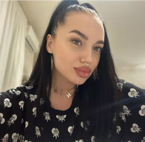 Her new lips are fine , but I miss her old lips they been top tier by bimbol0ver