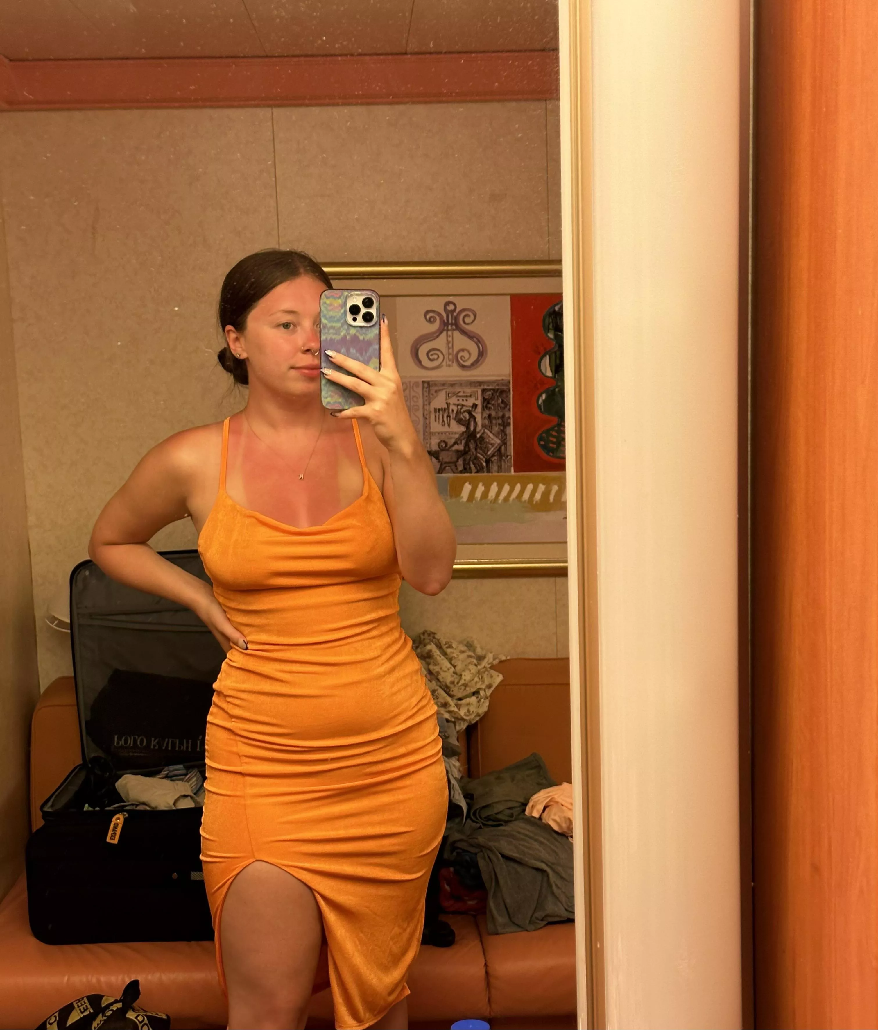 little burnt from the sun >.< posted by kristiidf