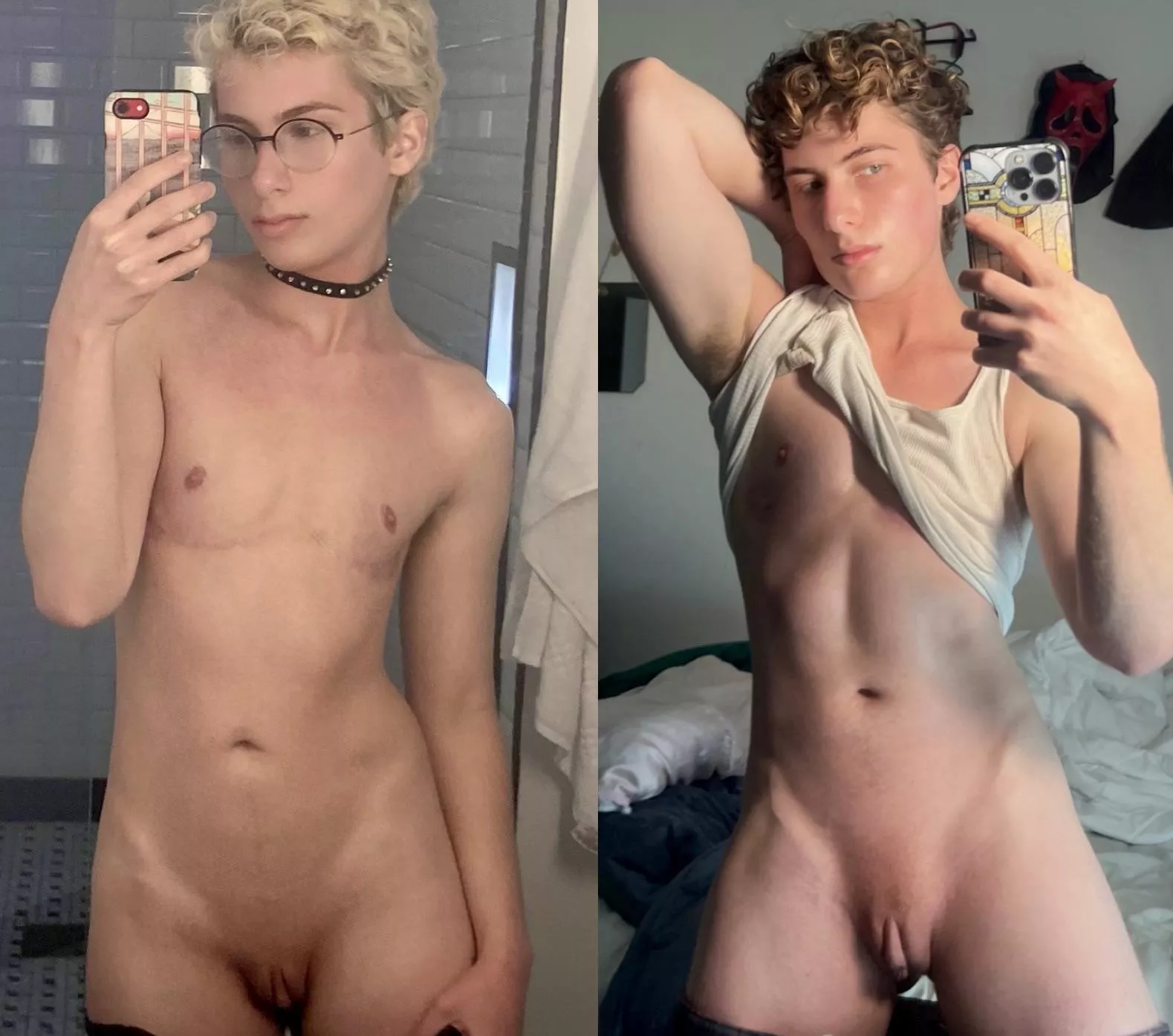 Two to four years on testosterone (FtM) posted by noahwaybabe