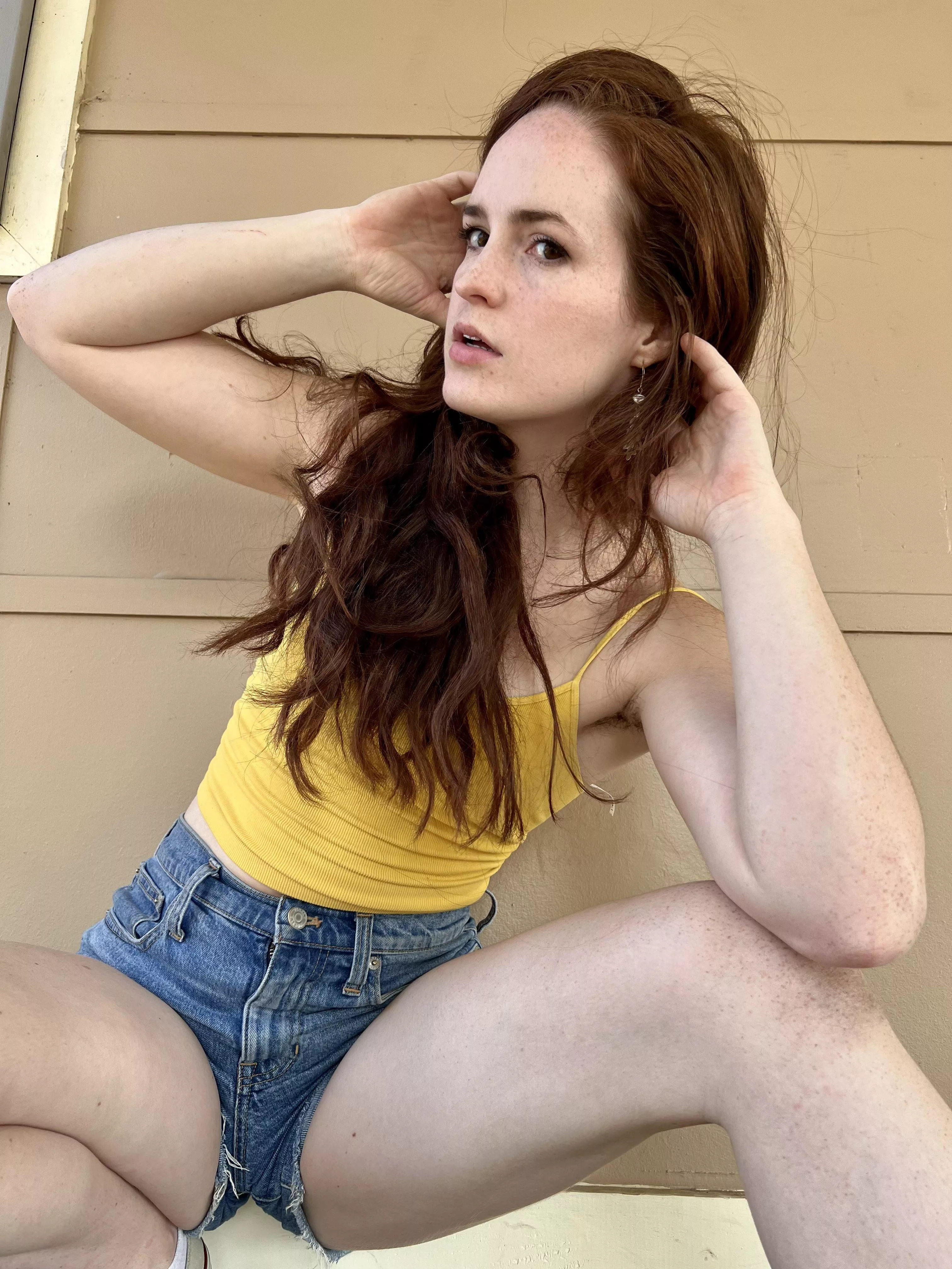 Would you love on my freckly knees and elbows too? posted by saltysweetcaroline