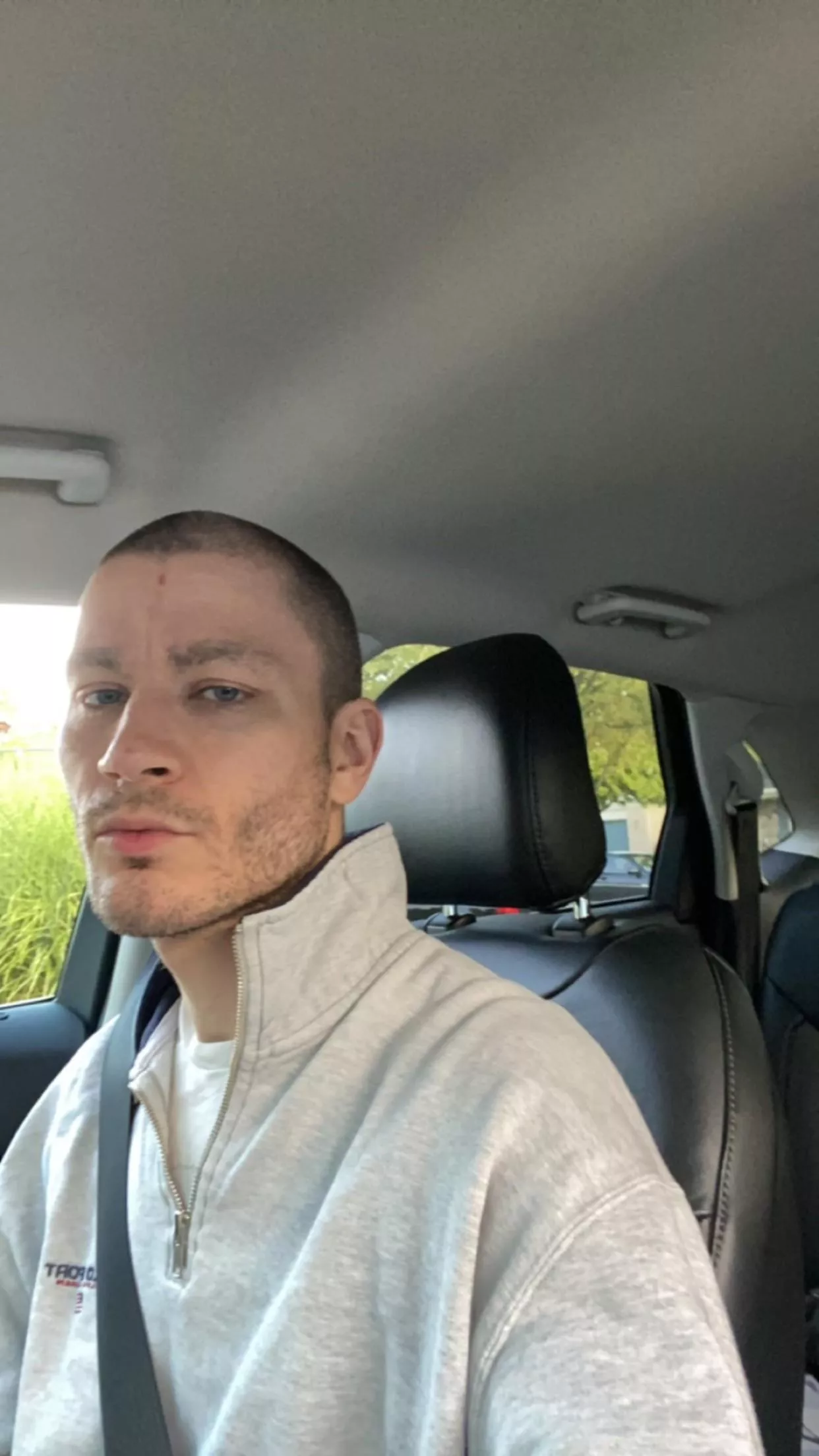 Guilty of a very modest duck lip. I think gaymers like ashnikko. Listening to weed killer in the 🚗 posted by druachu