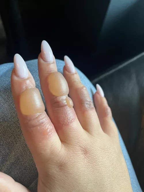 I know I can’t pop these but oh man… by Casscandra