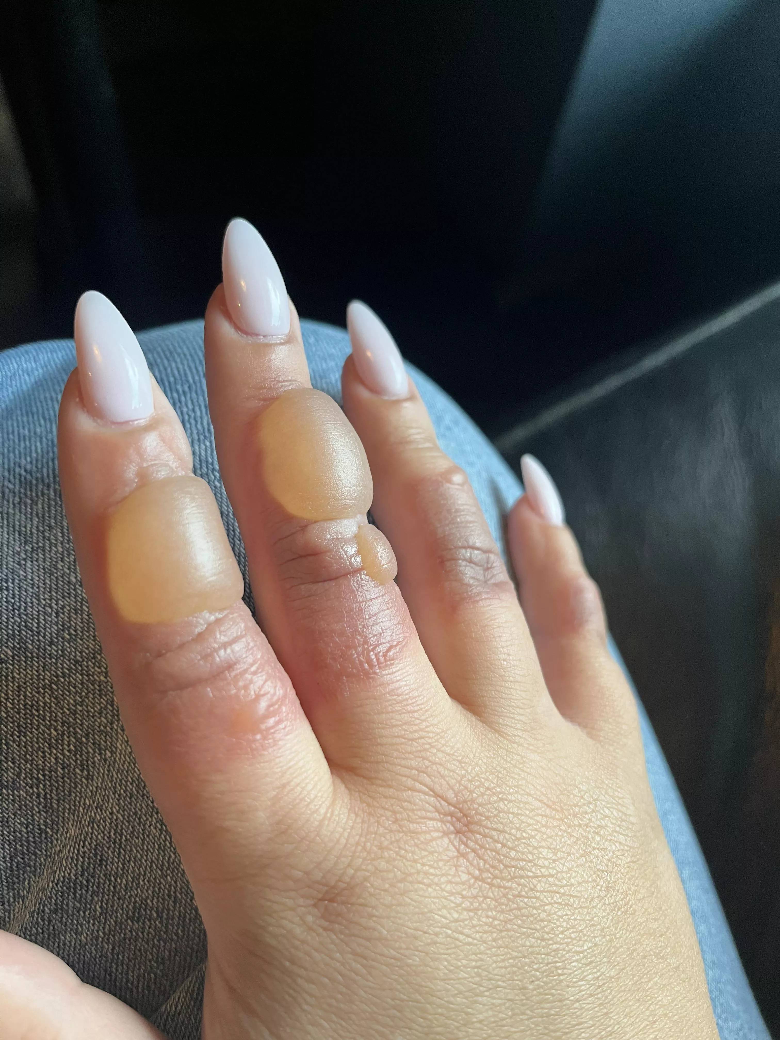 I know I can’t pop these but oh man… posted by Casscandra