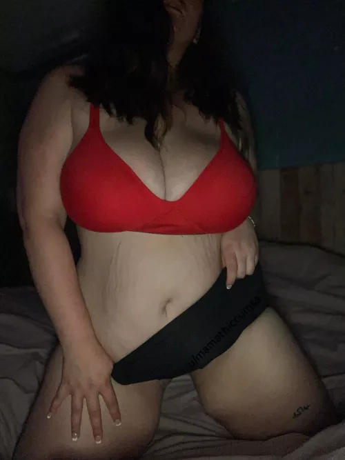 Do stretch marks bother you? by mamathiccumss