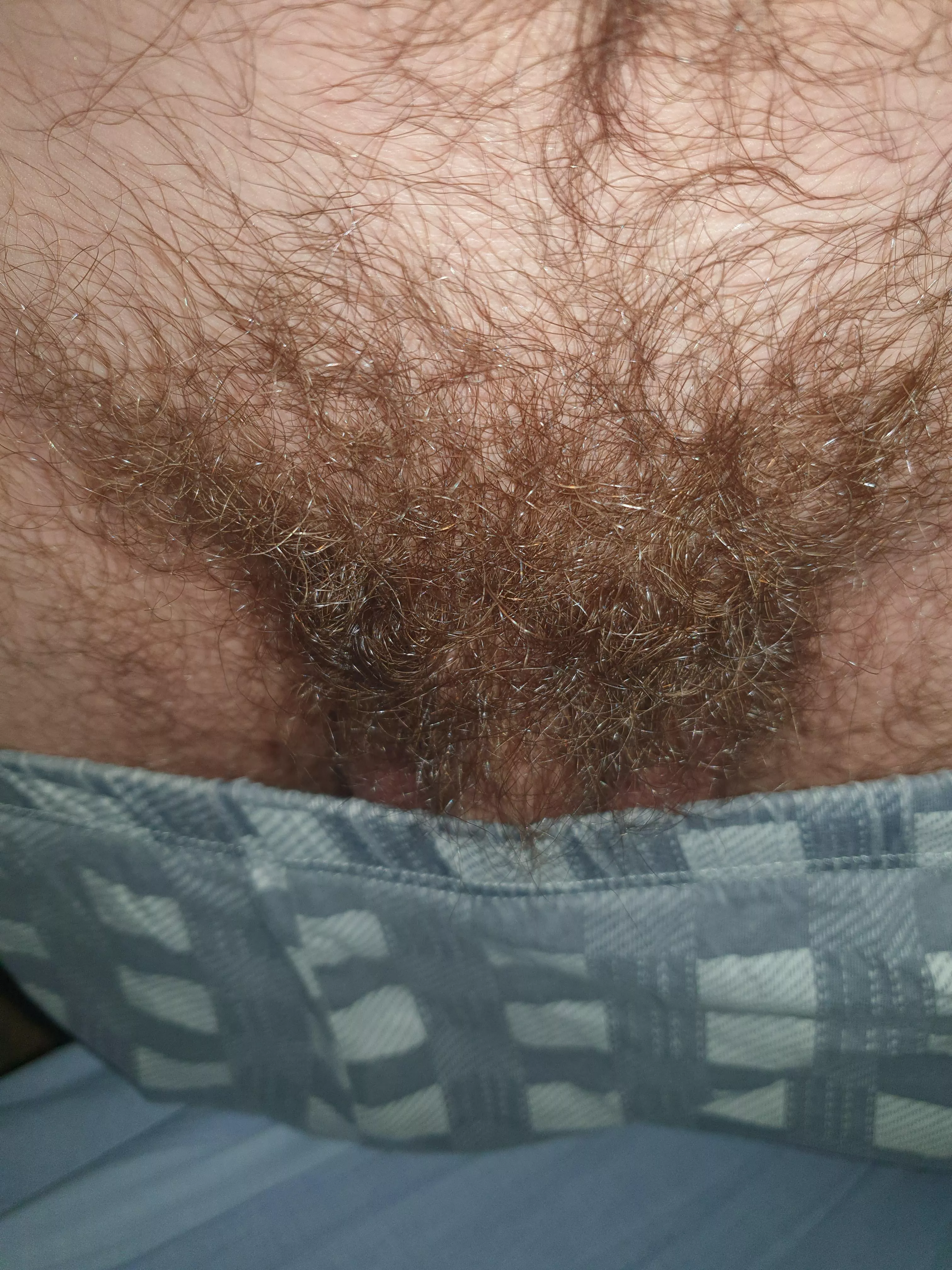 I think i need some treatment for my pubes posted by Naughty_Alex1