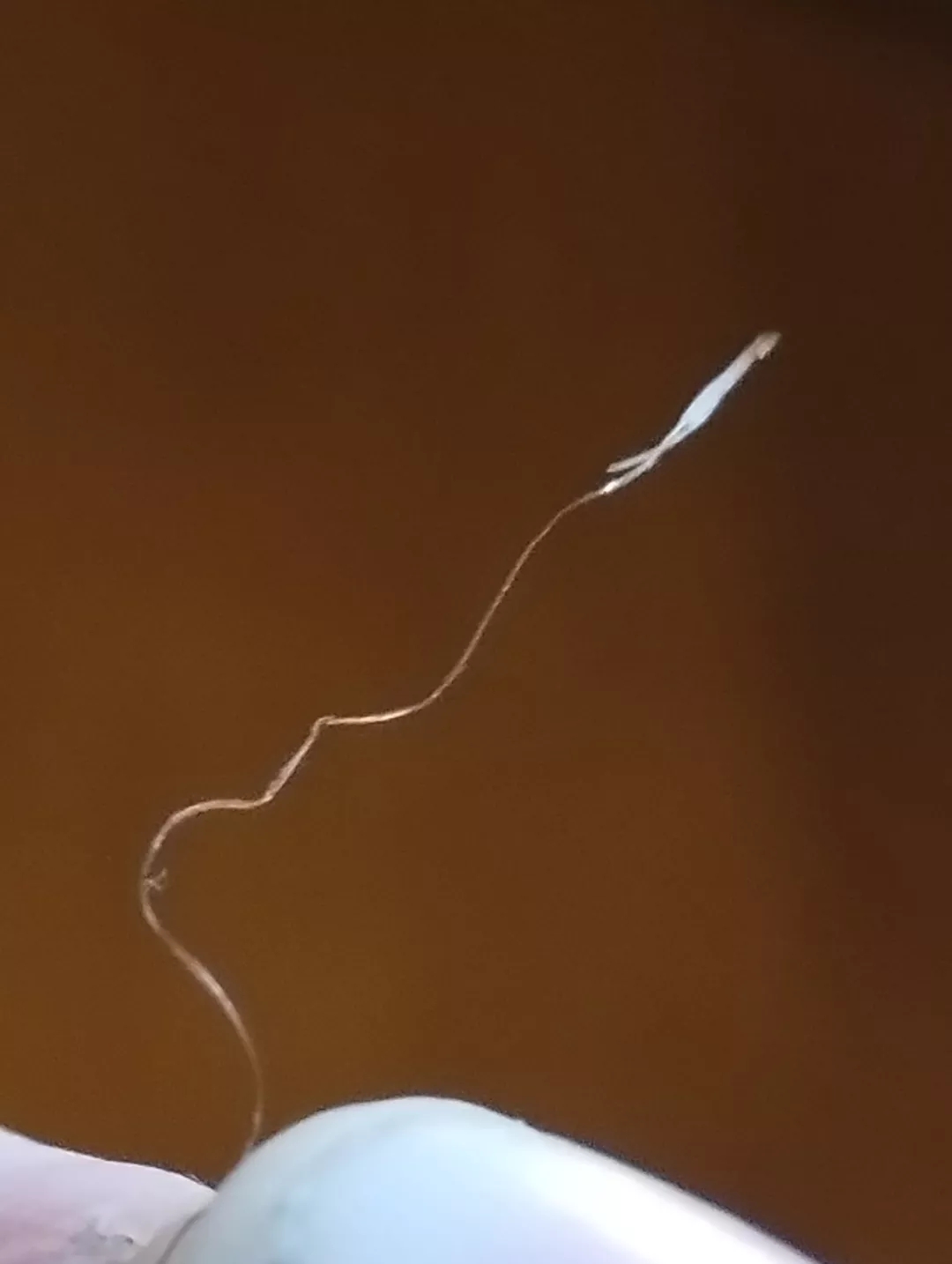 Long time lurker first time poster folliculitis hair removed with the infected hair follicle posted by crumbycrabcakes