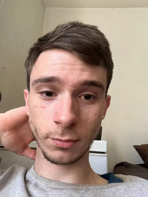 Scruff by Acrobatic-Bake2084