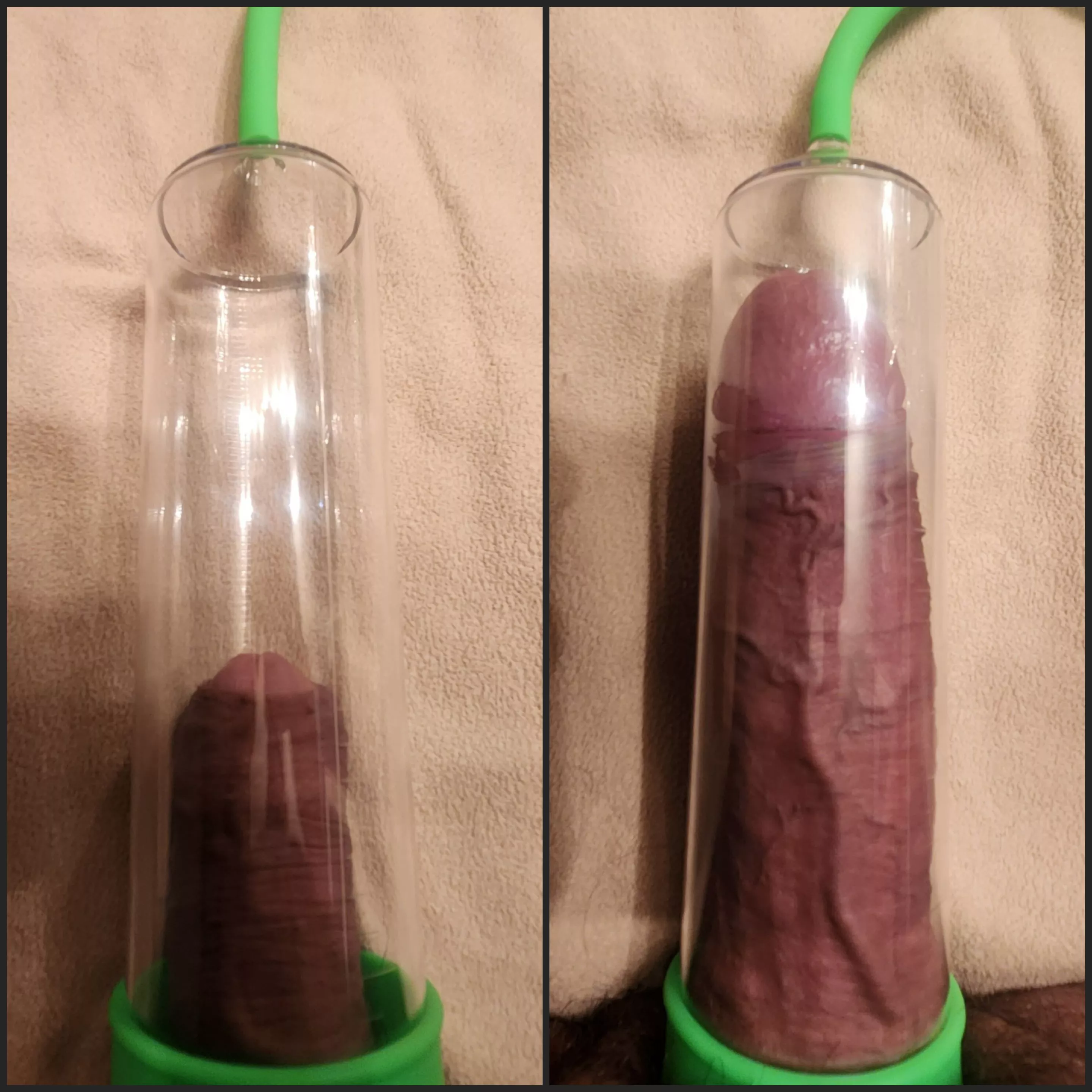 Finally joined the club posted by showmeyafreckles