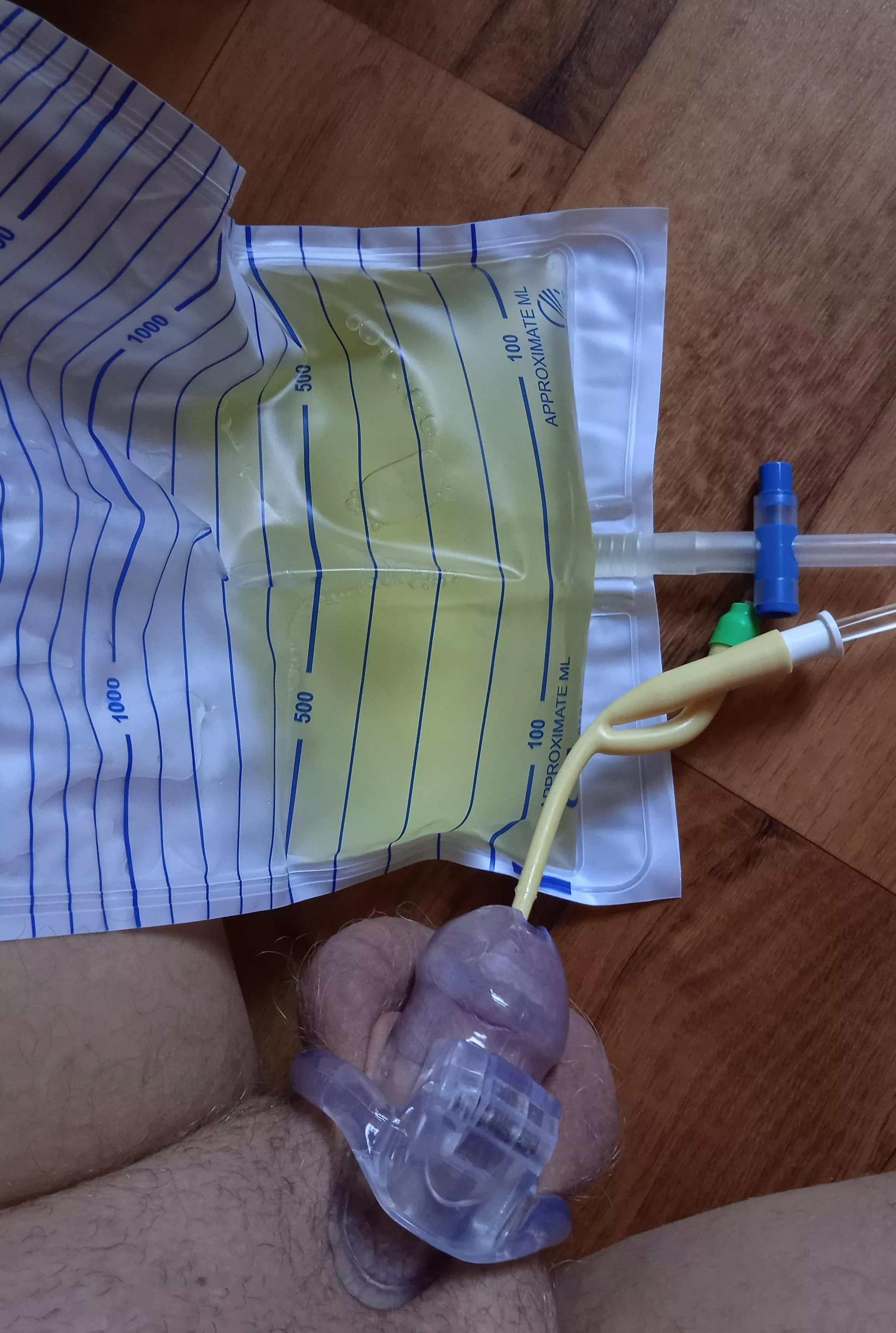 Chastity and catheter combo posted by MarcoMesini