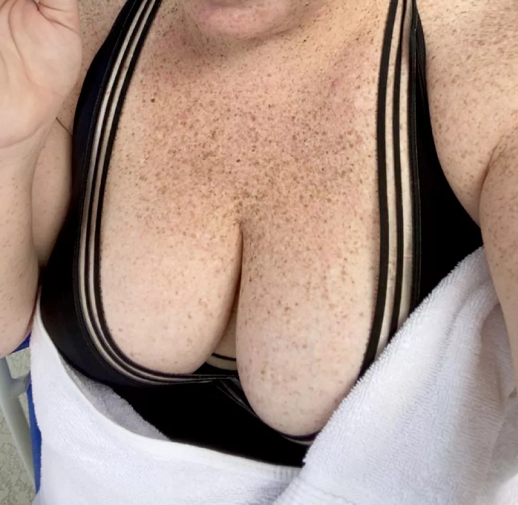 Whenever someone compliments my freckles, I know they mean these posted by Semolina__Pilchard__