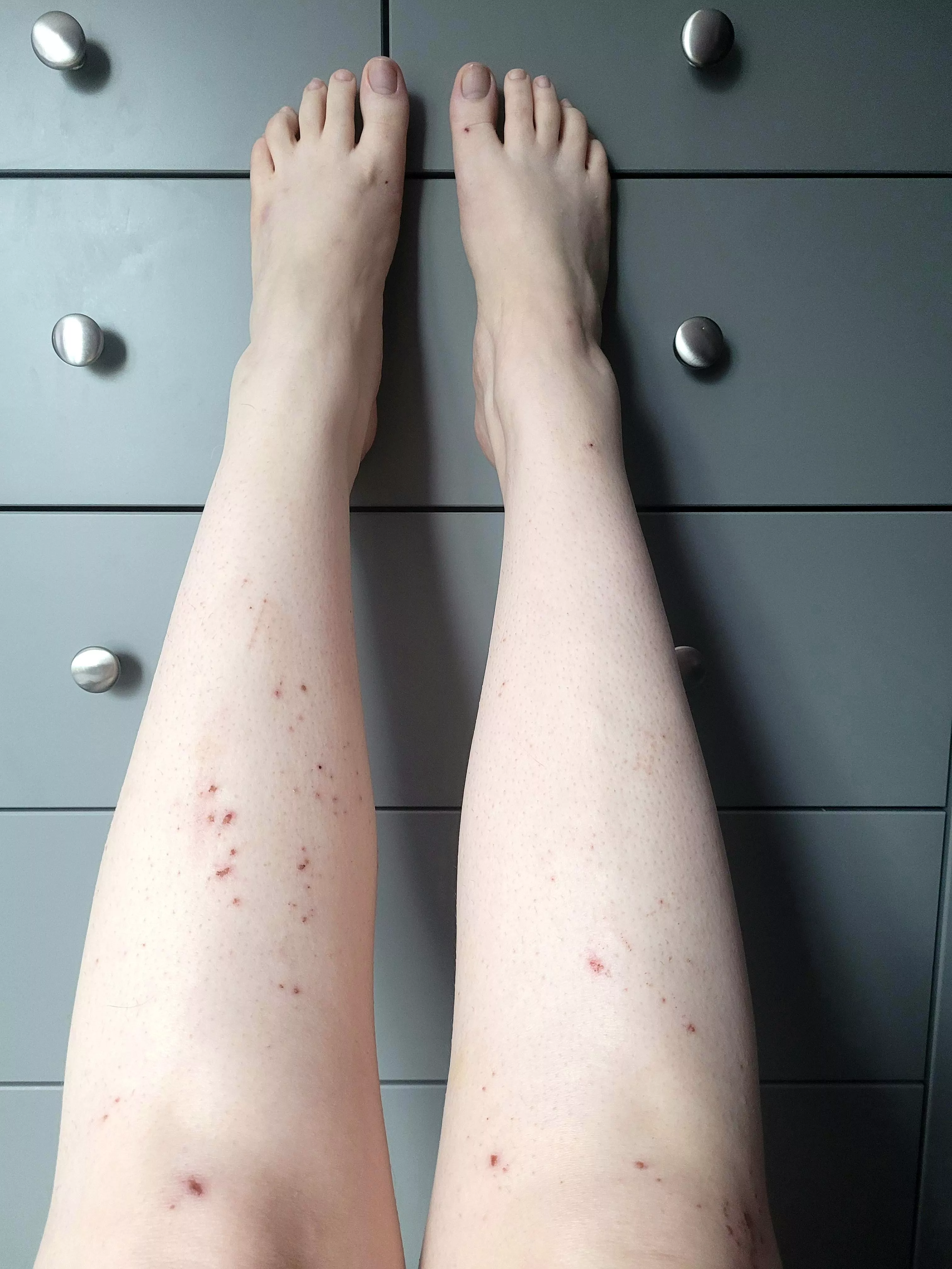 In desperate need of some tlc posted by myfeet_pics