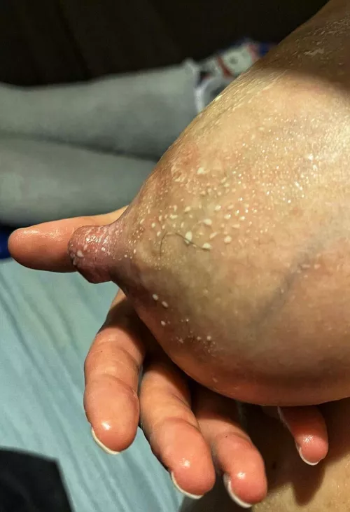 Leaking again by Ok_Wrongdoer_1741