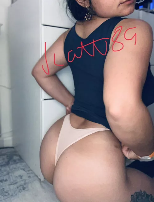 Resurfacing after 4 years (F) by jcatt89