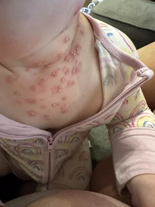 Forbidden pops on my 9 month old by sapc2