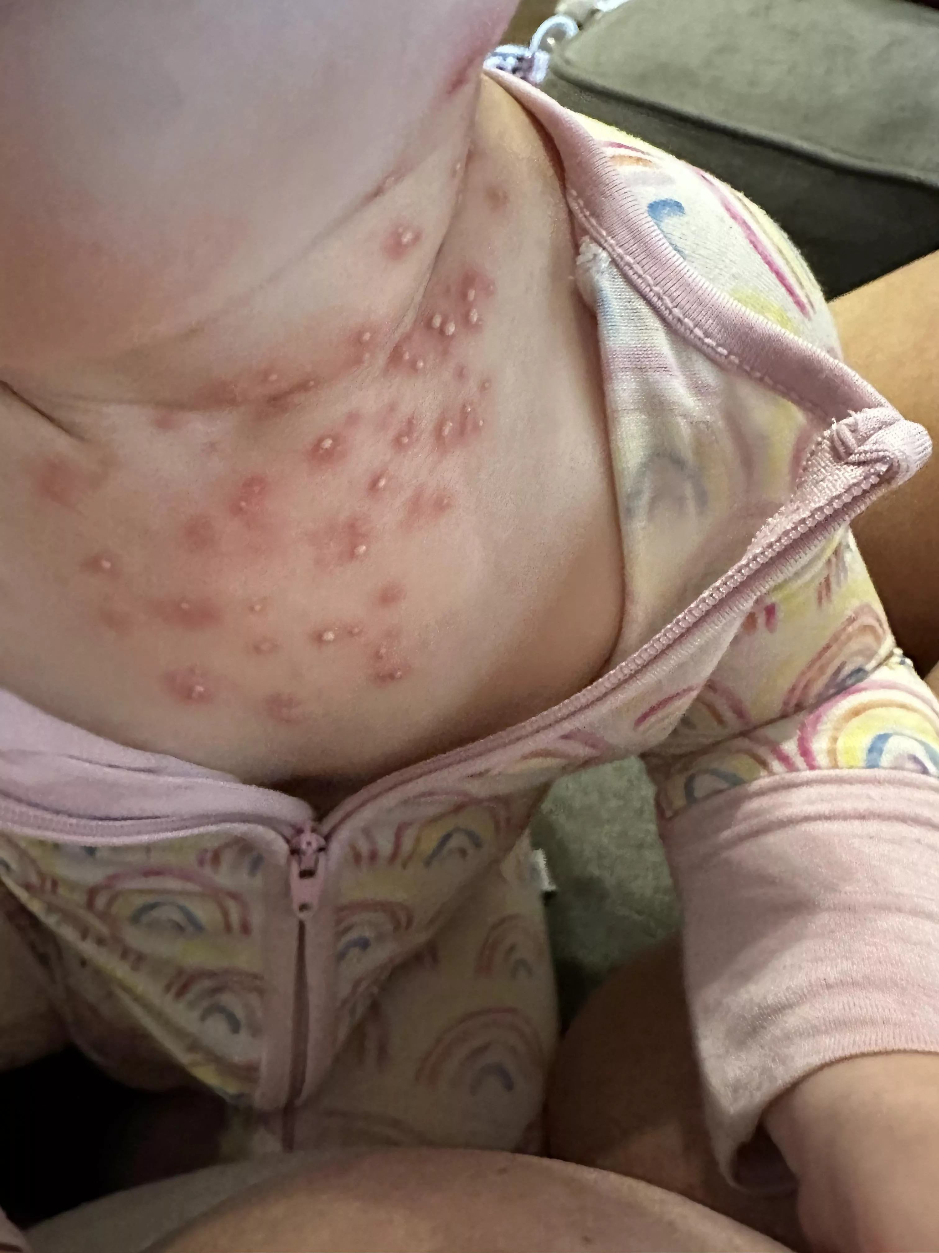 Forbidden pops on my 9 month old posted by sapc2