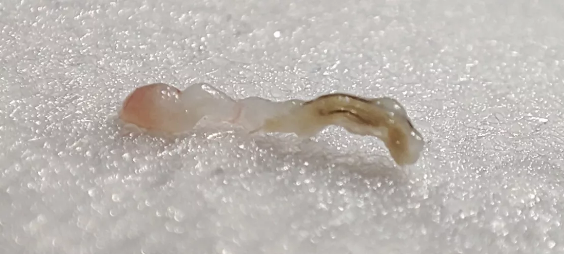 Say hello to my little friend! From my back. Couldn't record the pop. by Infospy