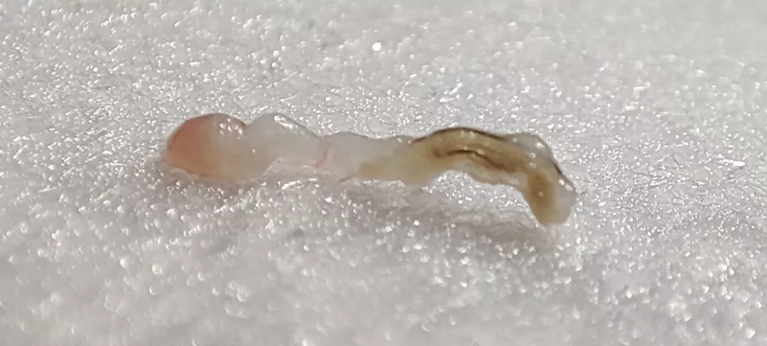 Say hello to my little friend! From my back. Couldn't record the pop. posted by Infospy