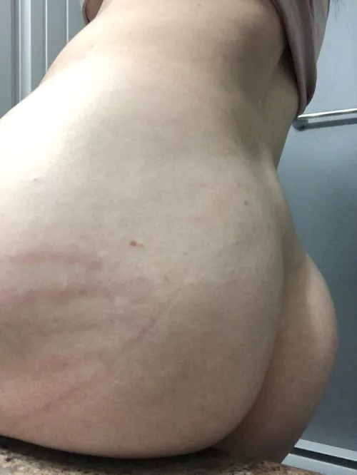 Still have my mark from last night by jessiemotionless