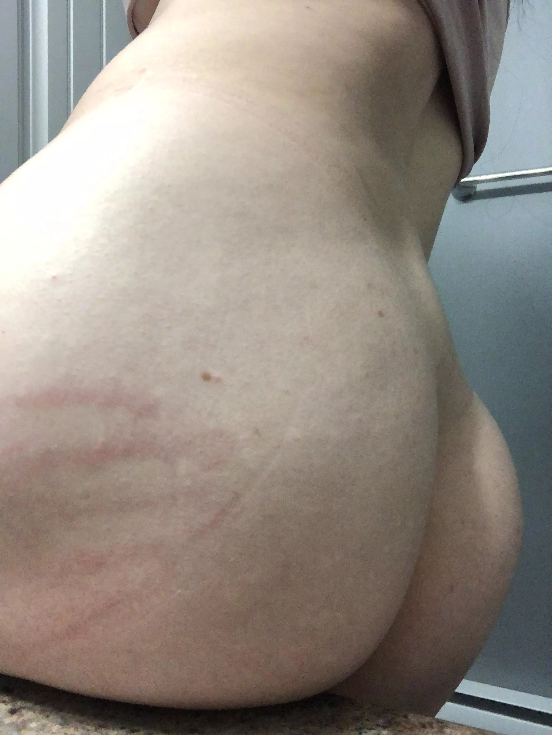 Still have my mark from last night posted by jessiemotionless