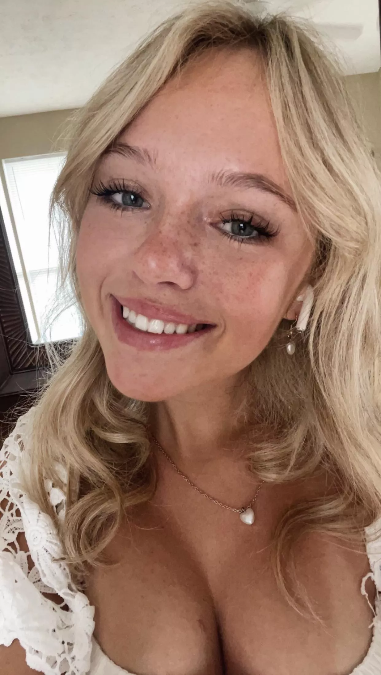 Freckles (IUTR) posted by throwaway7281648