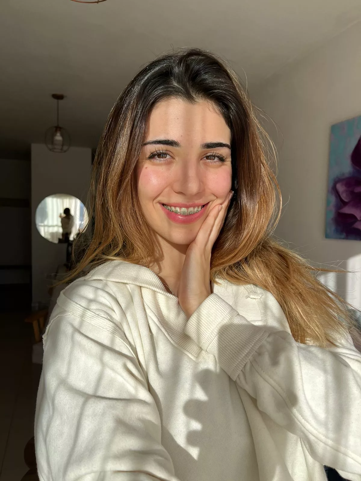 IUTR braces, freckles and dyed hair posted by LivingInitiatives