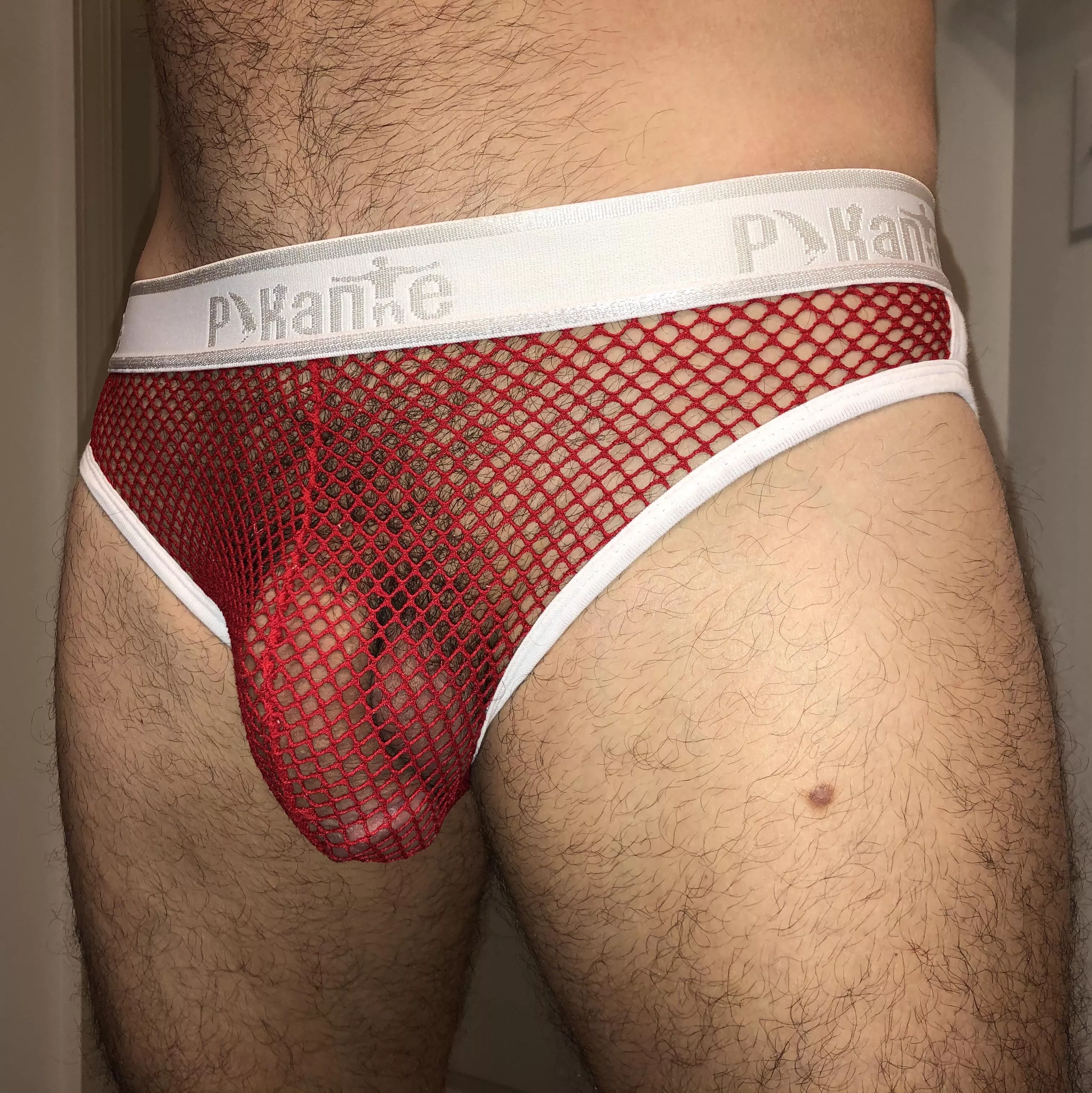 Mesh bulge posted by Chavez2023