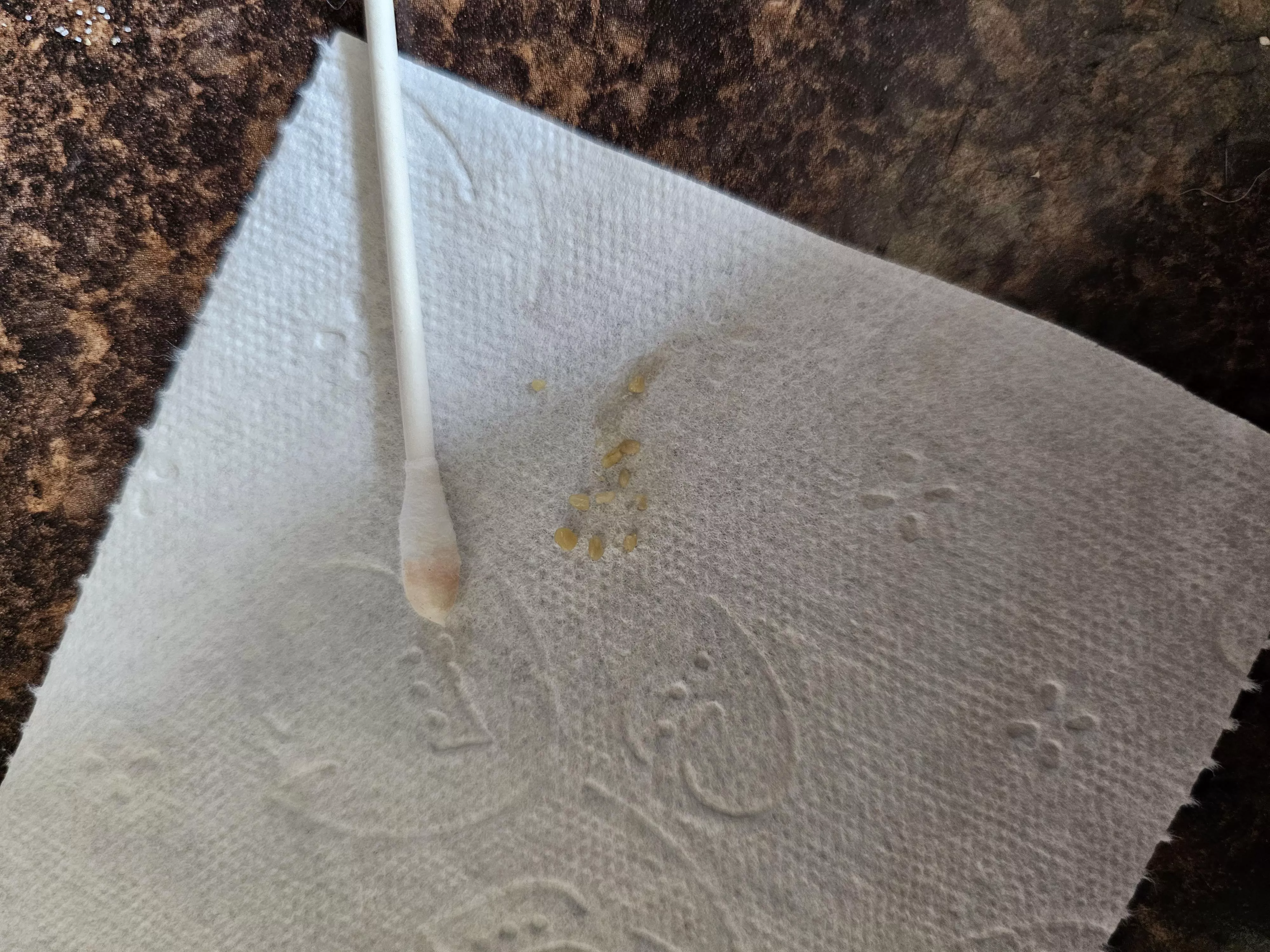 Tonsil stone haul after only 1 day posted by Purrrista