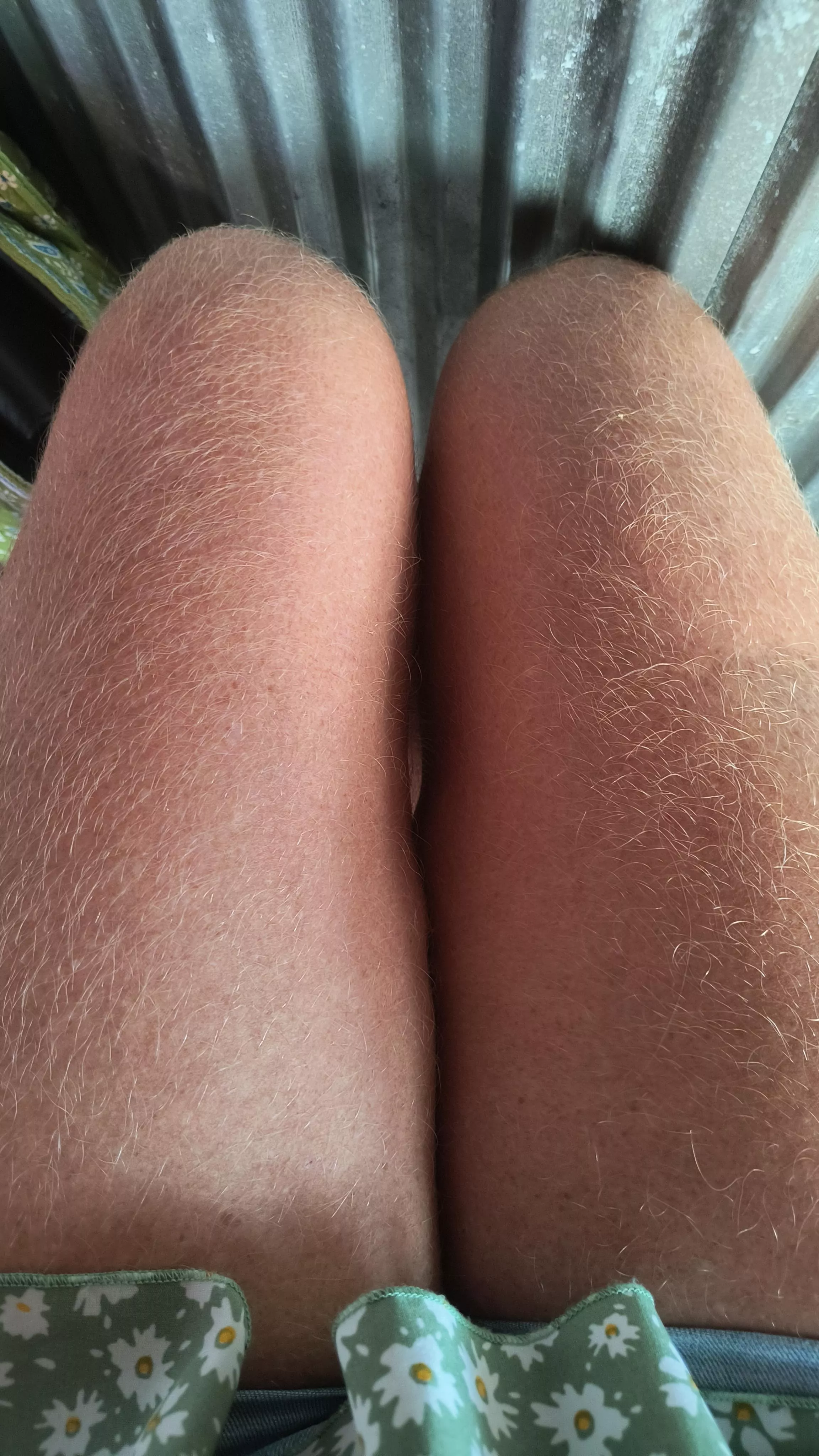 Would you fuck this hairy thigh gap? posted by AccomplishedEagle499