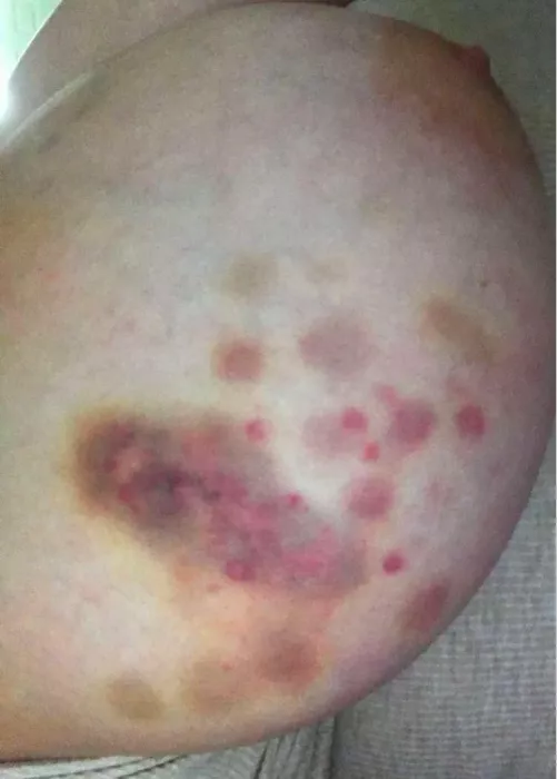 Hammered 🔨 by MSQZ_XO