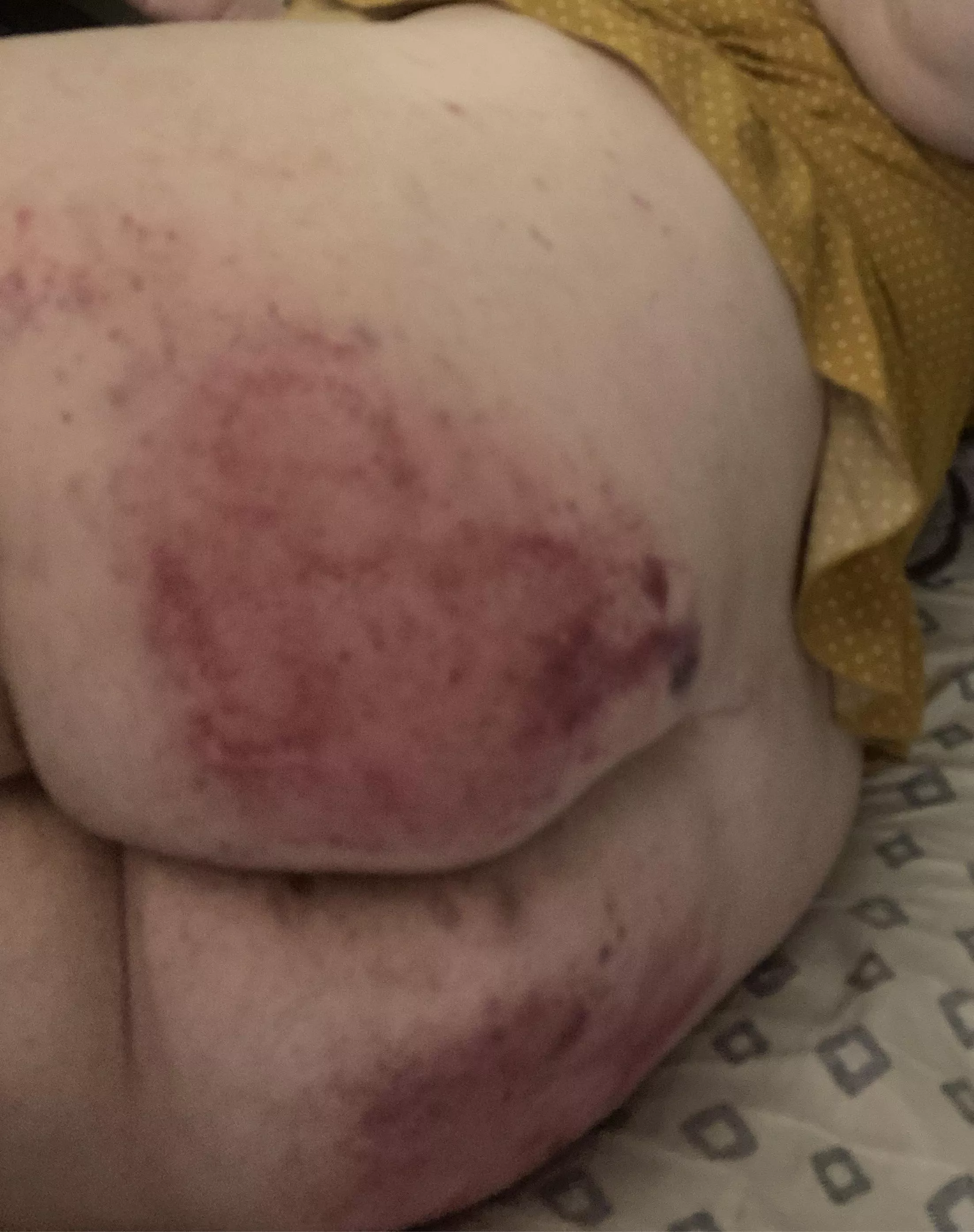 Killer spanking posted by Theholeyghost69