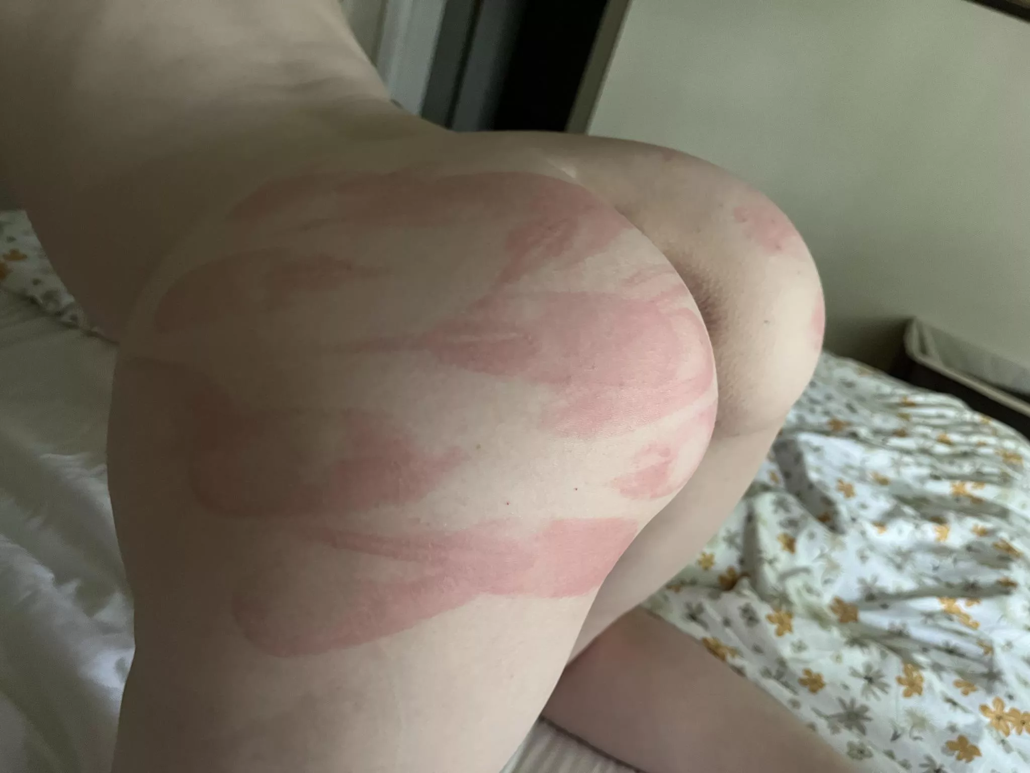 Love my marks! [F] posted by icing_25