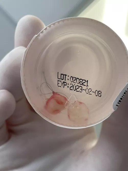 surprise pilar twins by kubbawubbaz