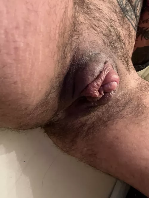 26 [ftm] I can’t stop playing with my pumped fat lips and clit by subcuntboy4dom