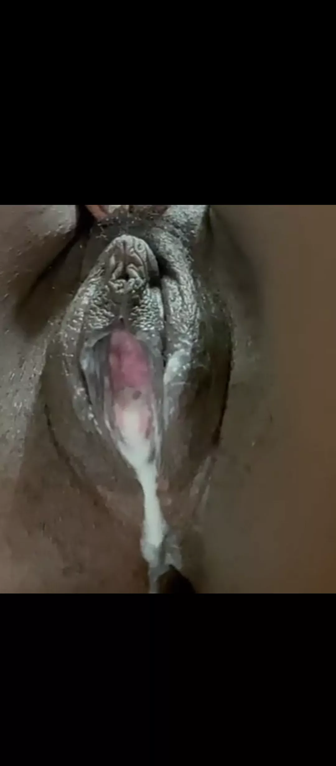 It was weird but it was good posted by medicalenhanceBBC