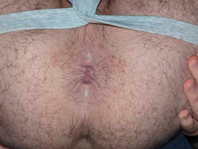 What are you going to do with my hole? by SocietyOk4865