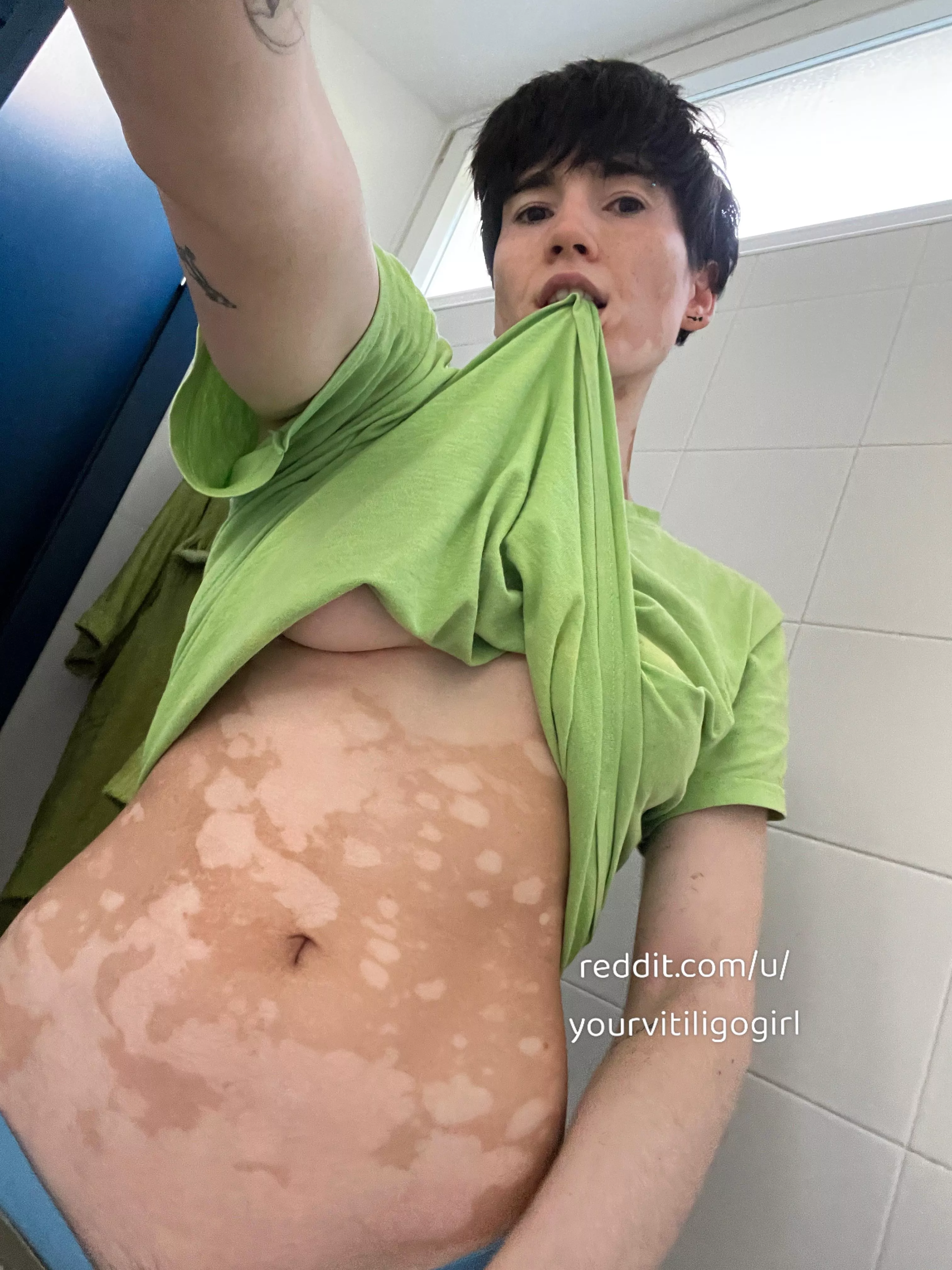 A pixie to fulfill your fantasies posted by yourvitiligogirl