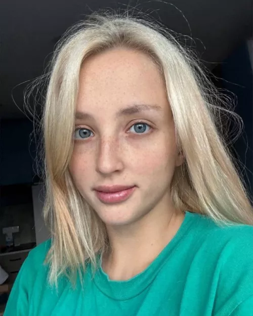 Ex boyfriend said he hated my freckles by AyliasTheCoder