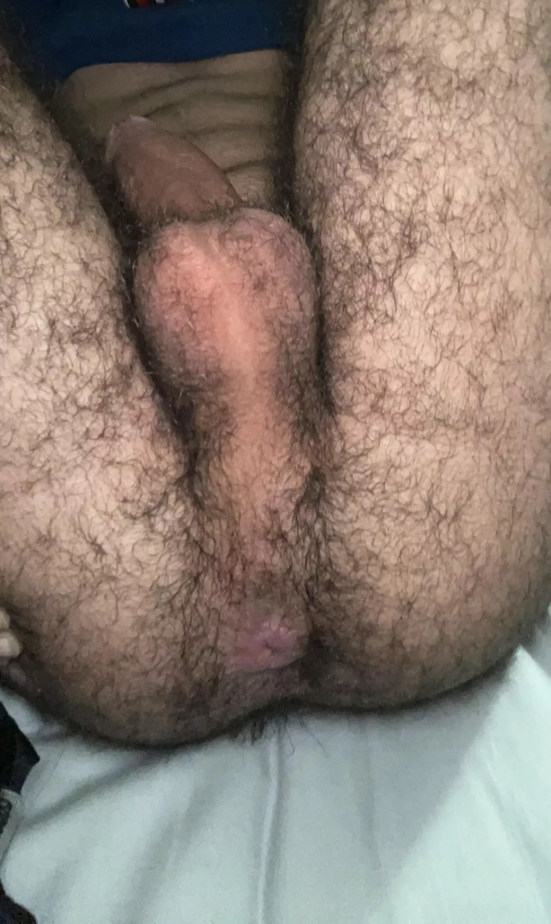 Hairy enough? posted by Dry_Classic6932