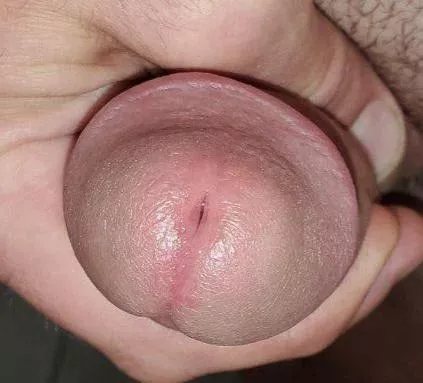 My dickhead posted by jerkitjake420