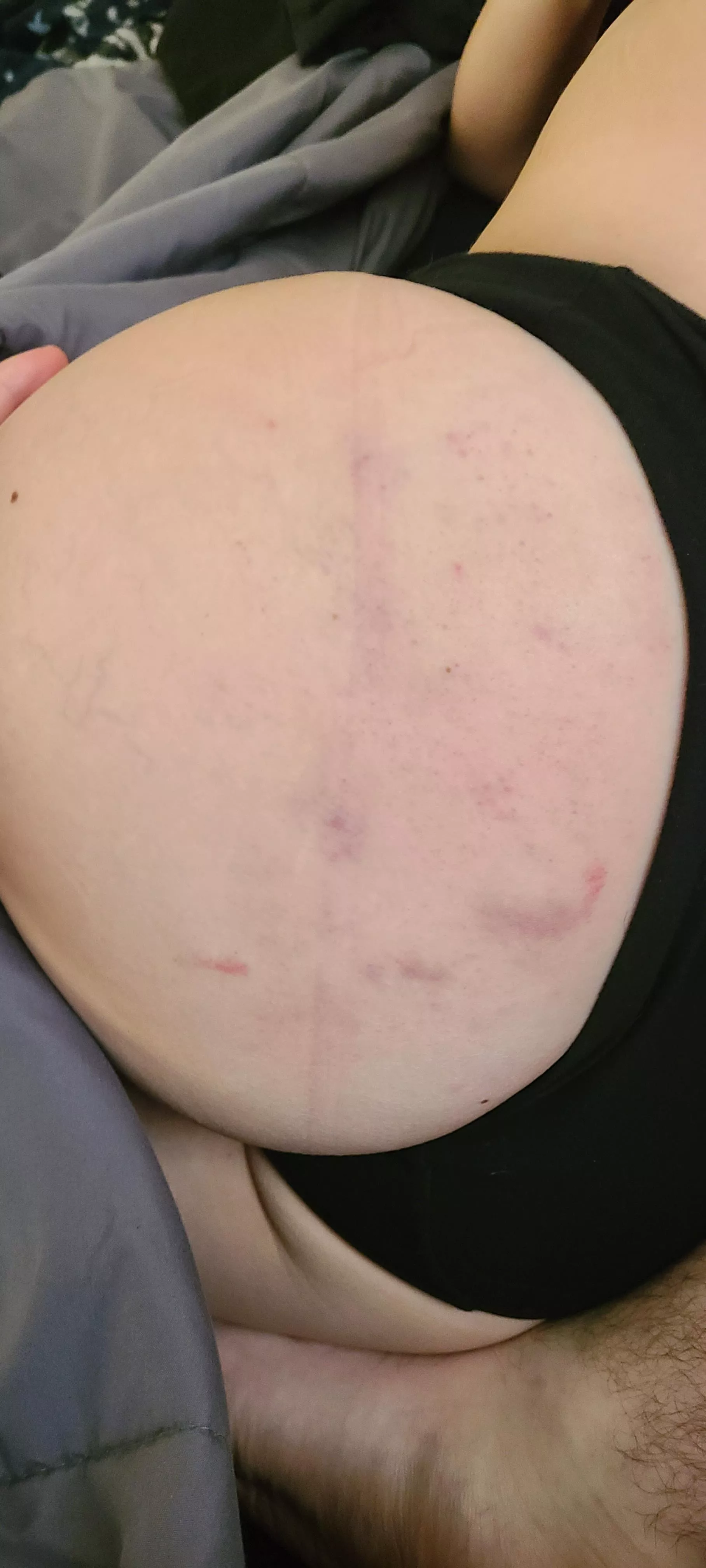 Aftermath of yesterday's booty slaps posted by nahtethrowaway2