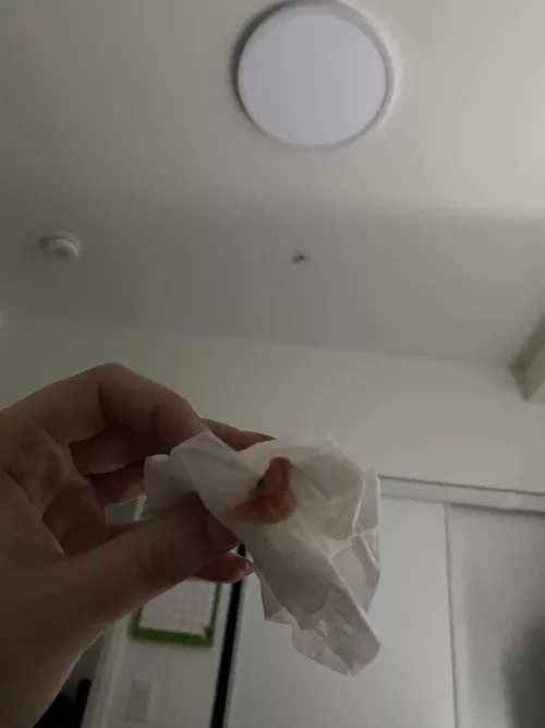 Blew this out of my nose today. Pretty sure I have Covid. by crimsonlights