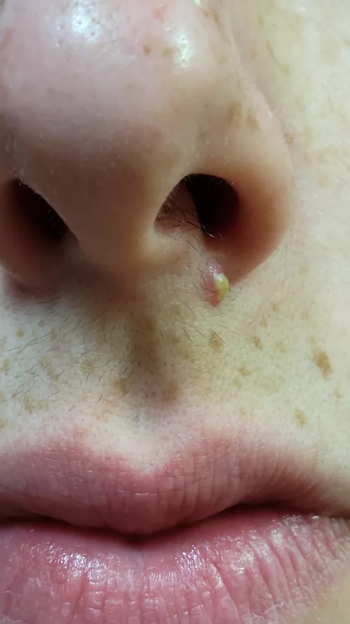 I have school and work tomorrow, would this be better or worse to pop it by joeyischillin