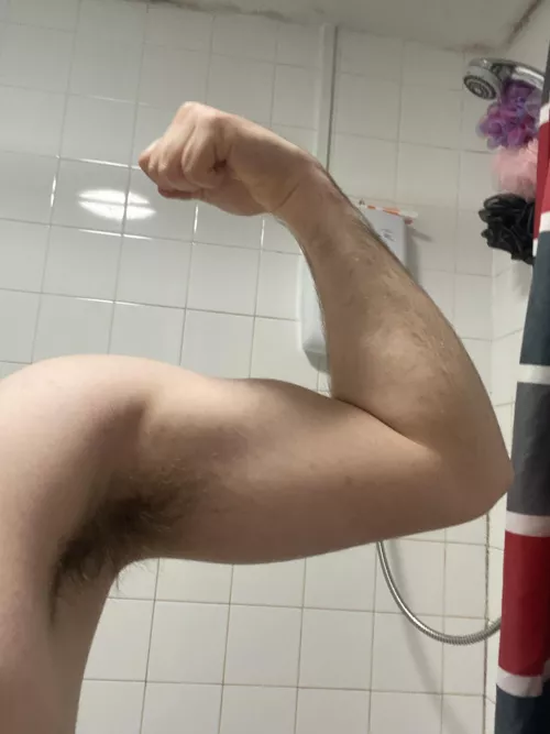 What colour are your armpits? by Comfortable-Pea-1930