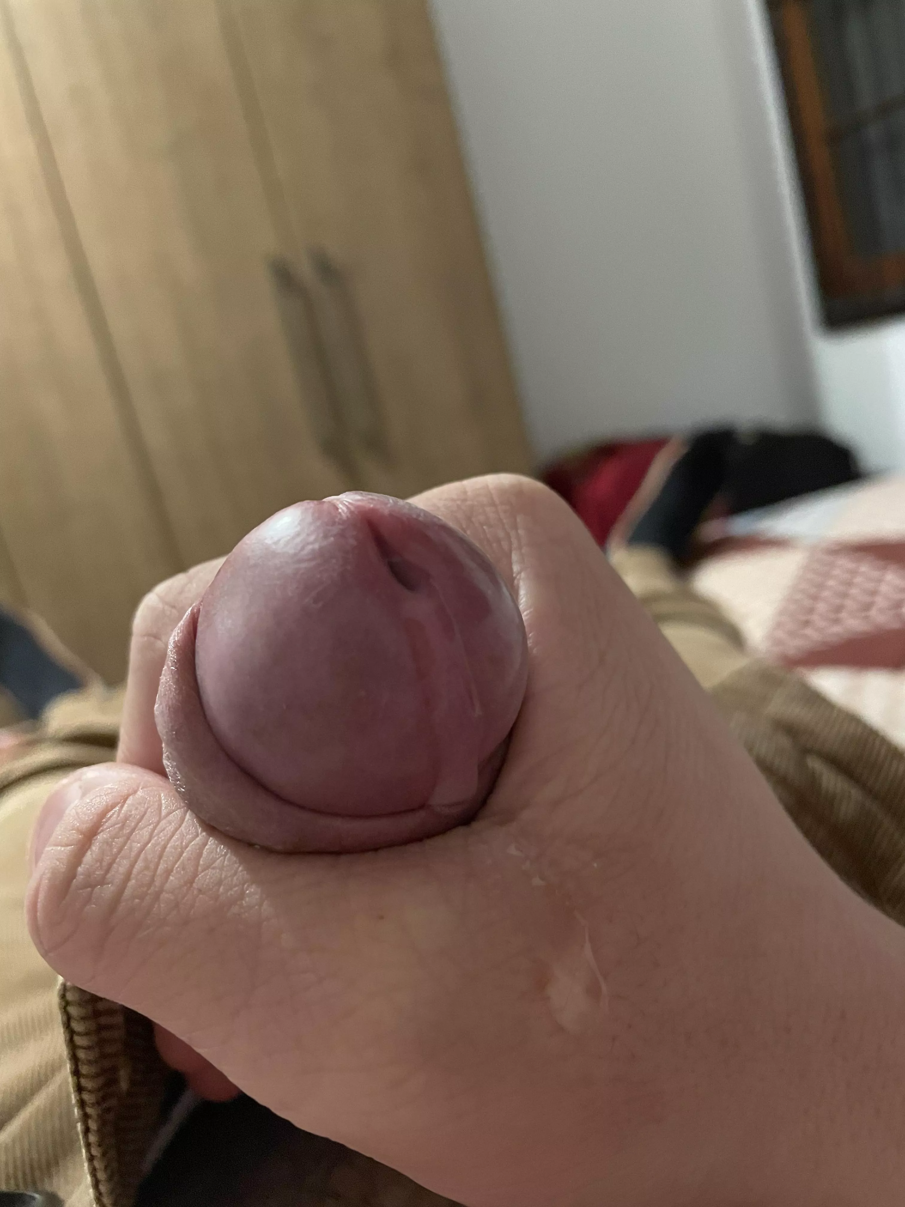 5 days since I last came posted by Such_Toe8443