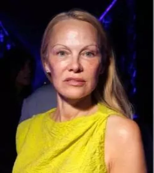 Pam Anderson-gone wild by going out in public w/o makeup by RhinoGreyStorm